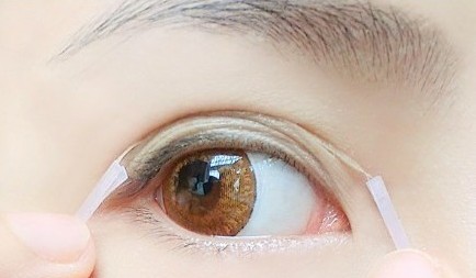 专家：双眼皮贴可使皮肤失去弹性