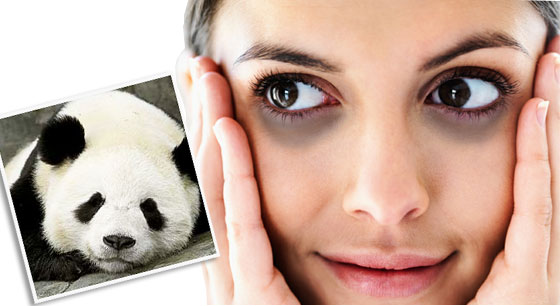 黑眼圈,熊猫眼