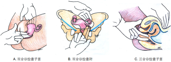 让人闻之色变的直肠指检 又难受又没用？