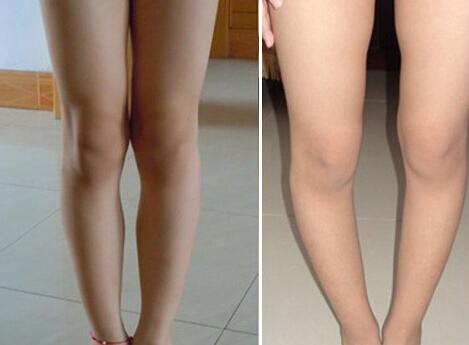 女生标准腿型到底长什么样？